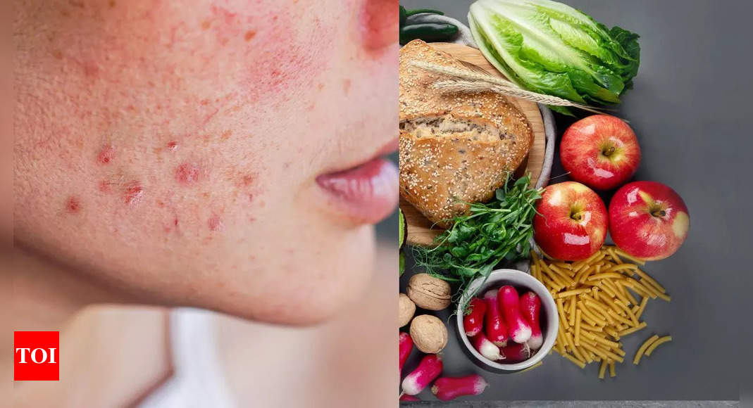 Foods that can secretly trigger skin allergies - Times of India