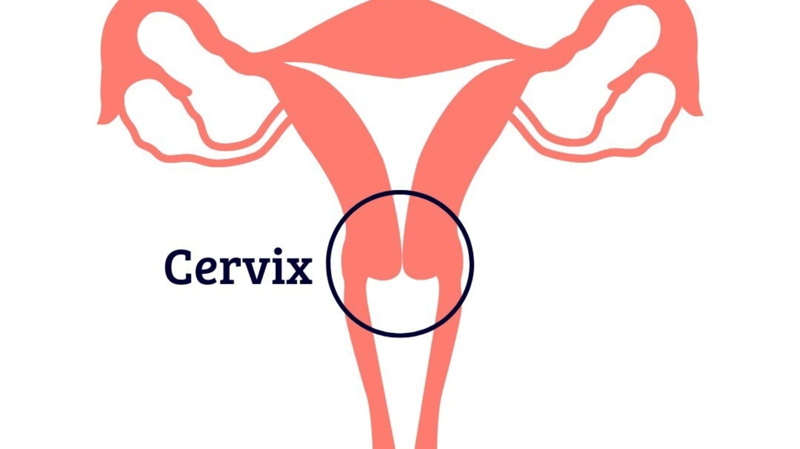 Irregular periods are not just menopause but can be sign of cervical cancer. Symptoms to watch out for
