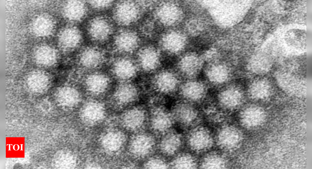 Norovirus Illnesses on the Rise in the US - What You Need to Know | World News - Times of India