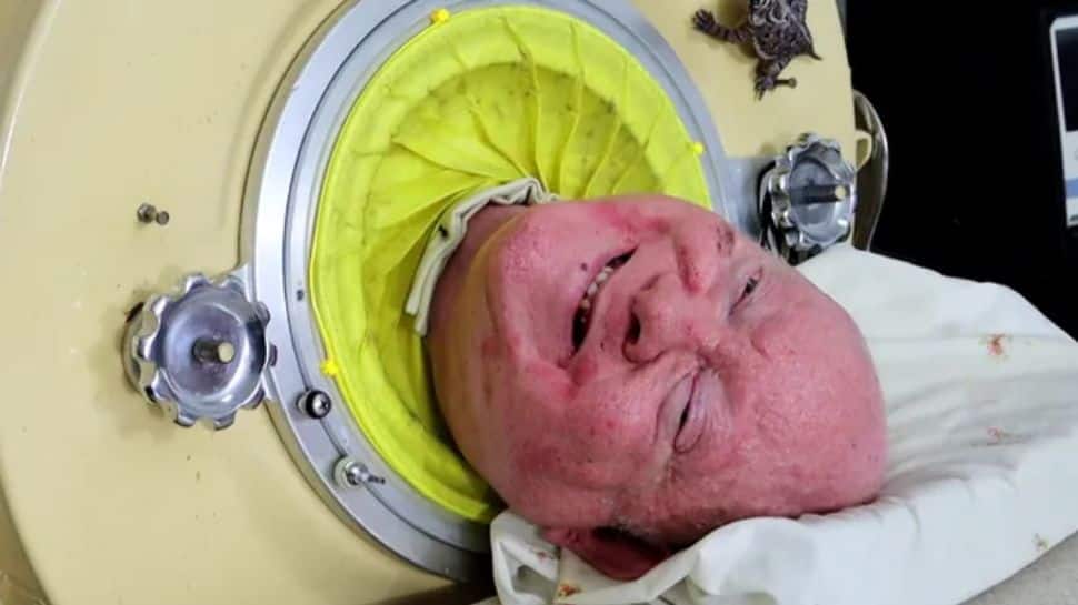 Paul Alexander: An Extraordinary Man Who Lived 70 Years Inside An Iron Cube - Wine, Women, Laughs